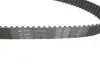 Роликовый модуль натяжителя ремня (ролик. Ремень) SKF VKMA 95666 (фото 4)