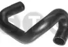 Шланг радиатора STC T408782 (фото 1)